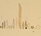 Thirty Diatom Species – Mounted Microscope Slide and Catalogued by Bernard Hartley
